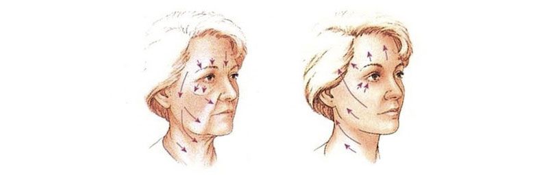 blog by-cosmetics ботокс